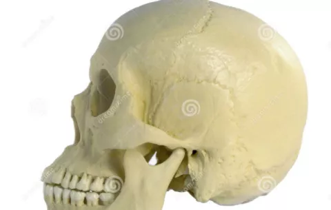 Implantan por primera vez un cráneo entero hecho con una impresora 3D