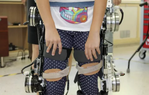 Paciente tetrapléjico logra caminar gracias a un exoesqueleto 
