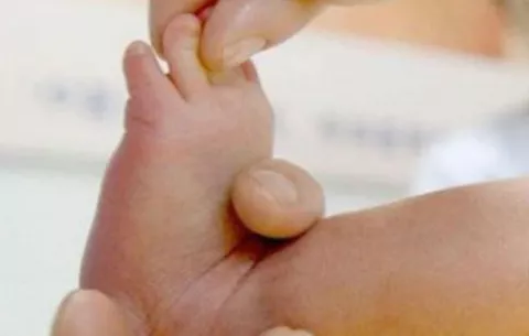 ¡Alarma! Advierten de 14 malformaciones de bebés en Francia