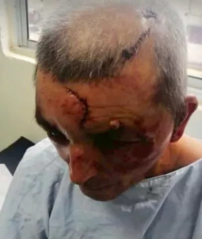 Delincuentes le dan brutal golpiza a una pareja en Siogui para robarle