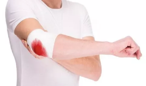 Concientización sobre la hemofilia 
