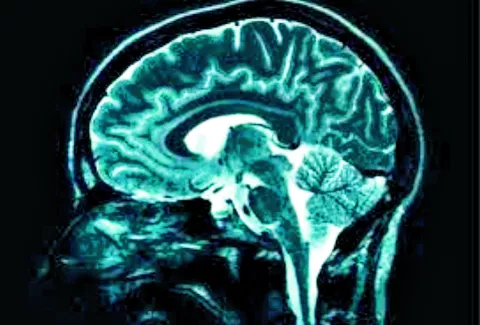 El cerebro de los suicidas es diferente al de una persona normal