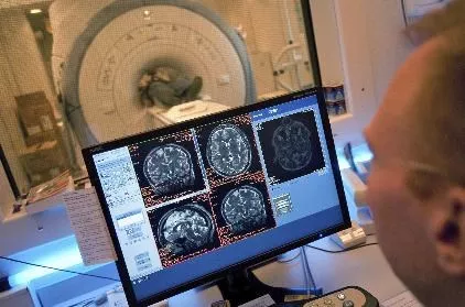 El 'reloj corporal' de personas con depresión puede alterarse a nivel celular