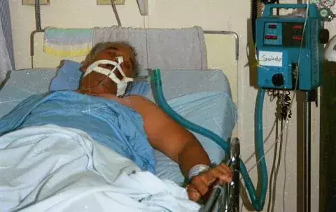 EEUU dona 5 millones de dólares para combatir tuberculosis en América Latina