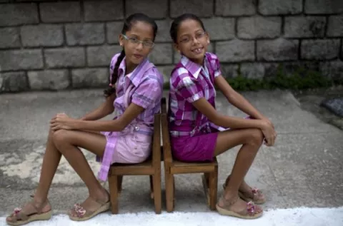 12 pares de mellizos o gemelos en dos cuadras de una comunidad de La Habana