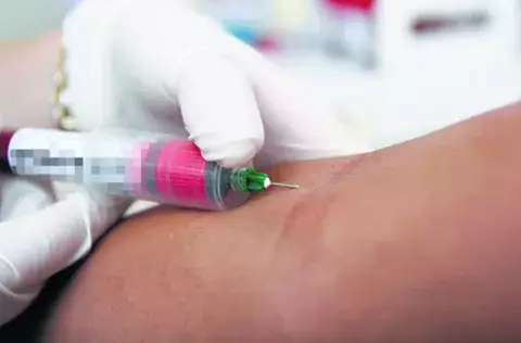 Epidemia en Panamá ataca más a población entre los 15 y 49 años  