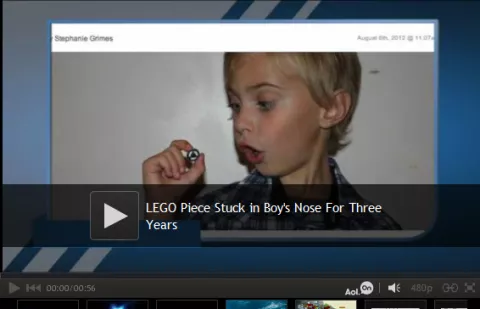 Niño perdió una pieza de Lego y la encontró en su nariz