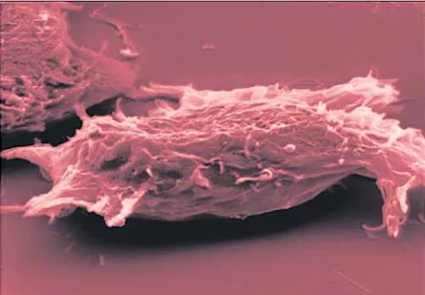 El cobre acelera el desarrollo de células cancerígenas