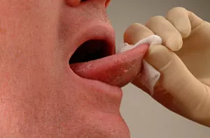 Mujer enfurecida le arranca un pedazo de lengua a su novio