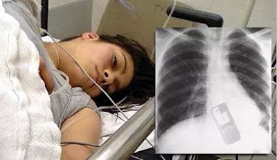 Mujer se traga celular para que su novio no leyera los mensajes