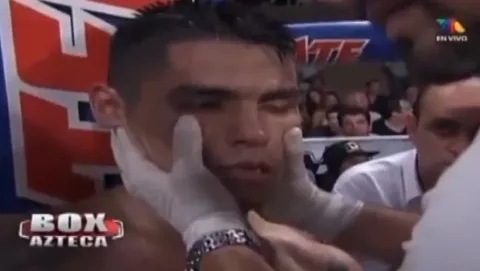 Boxeador muere después de un nocaut