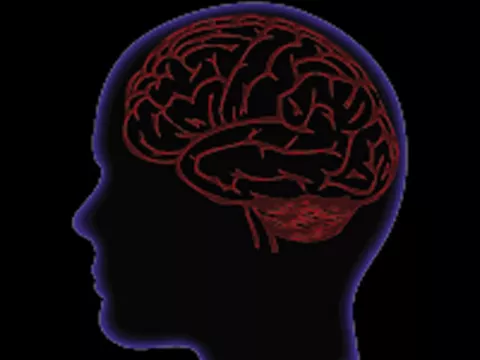 Cerebros humanos son más parecidos de lo que se creía
