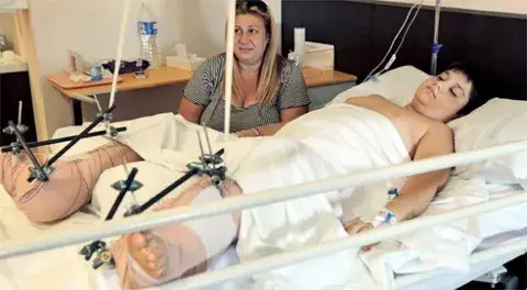 Reimplantan ambos pies a un niño de 10 años