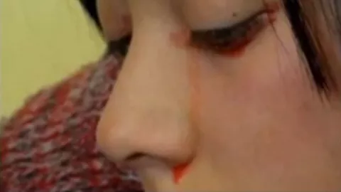Joven en chile llora lágrimas de sangre producto de una extraña afección