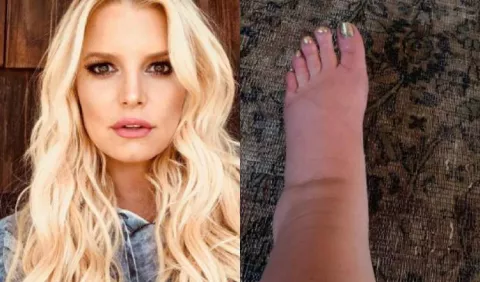 Jessica Simpson pide remedios a sus fans
