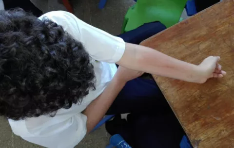 Más de 45 estudiantes con alergia en centro educativo de La Chorrera