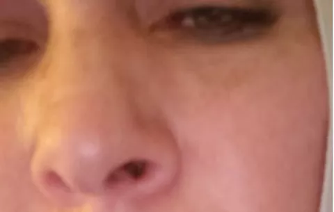 Mujer brutalmente golpeada en Barú, pierde la batalla por su vida