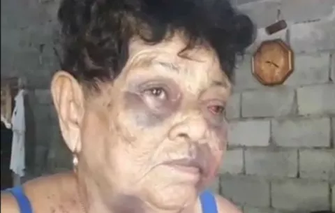 Ordenan detención a sujeto que golpeaba mujeres en el Valle de Las Lomas