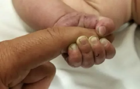 Se registra una baja en los nacimientos de prematuros en el país