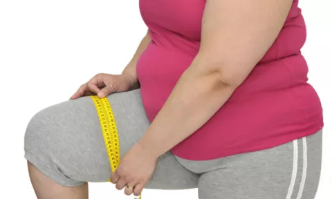 La obesidad en adultos mayores se incrementa