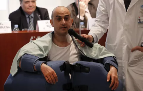 Hombre recibe trasplante de brazos