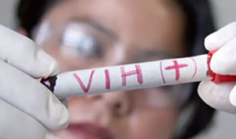 Aumenta cantidad de jóvenes con VIH en Panamá