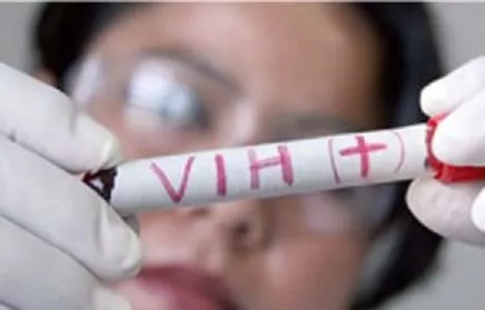 Efectúan trasplante de riñón de donante con el VIH a paciente con virus del Sida  