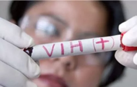 Descubren cómo una enfermedad genética muy rara protege contra el VIH