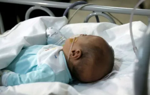 Confirman la muerte de cinco niños por el Virus Respiratorio Sincitial
