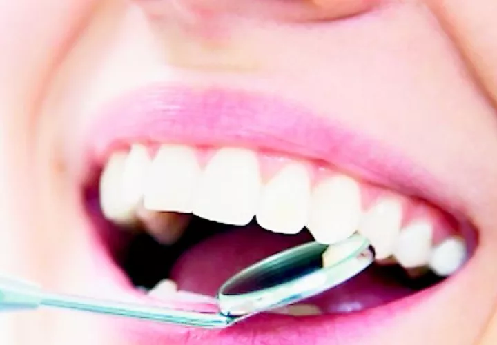 ¡Atención! Mejora tu salud bucal 