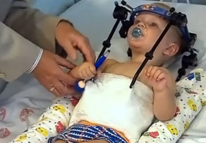 Le realizaron una cirugía milagrosa.