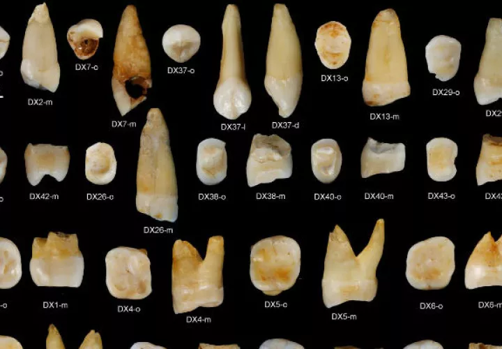 Son 47 piezas dentales. Foto/ AP