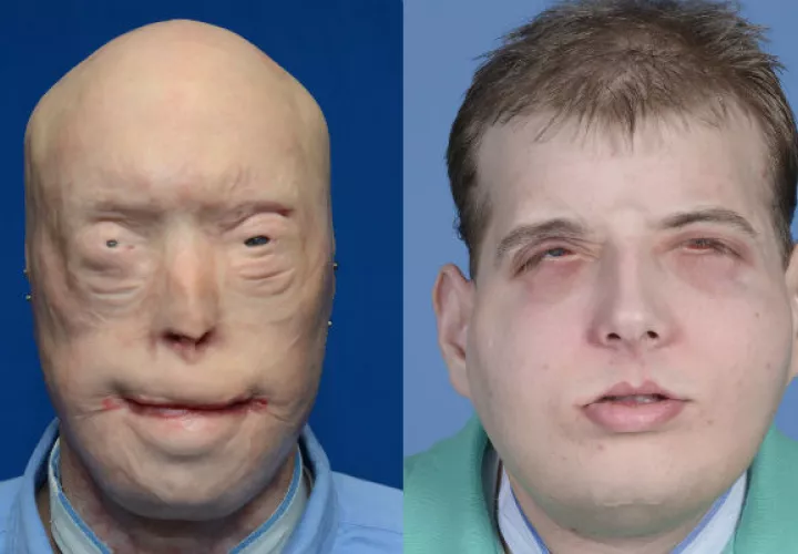 Antes y después de la operación. Foto/ AP