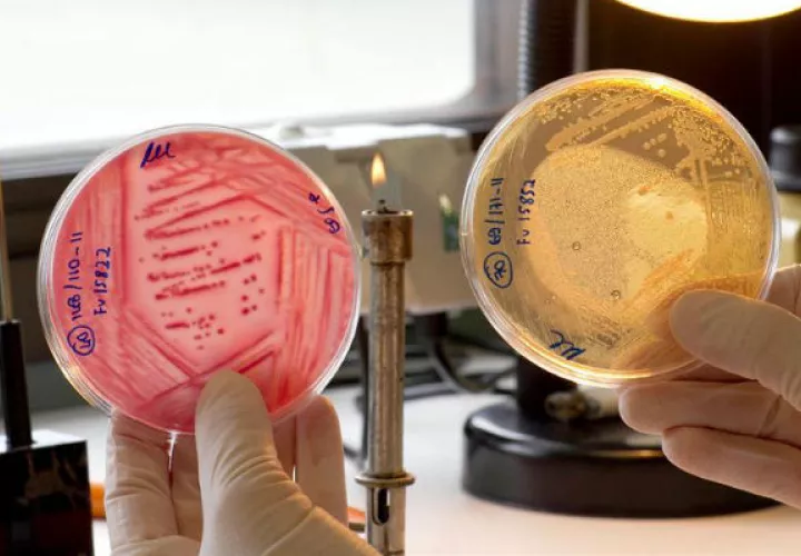 Muestras de placas Petri, sembradas con la bacteria E. Coli. A la izquierda E.Coli típico y a la derecha E. Coli atípico. EFE