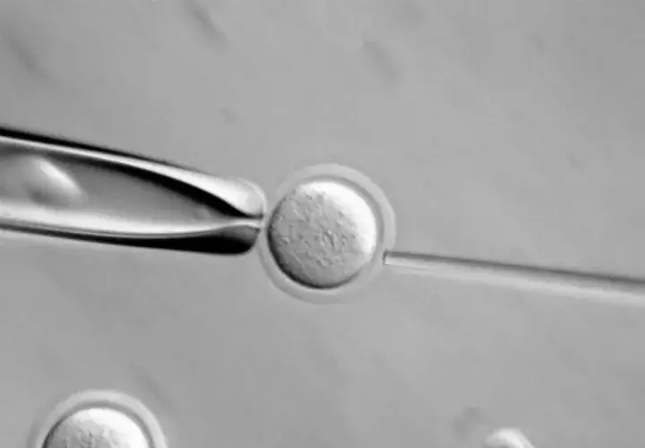Una imagen microscópica de una célula. Foto: EFE/Archivo