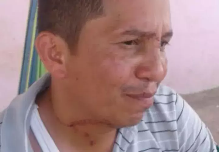Taxista herido. Foto: Zenaida Vásquez 