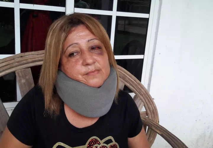 Condiciones en que quedó la educadora Karina Gómez Cortez. Foto: Melquíadez Vásquez. 