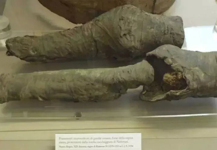Las piernas están en exhibición. 