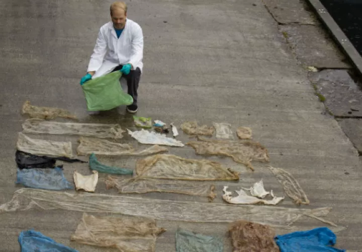 Tenía unas 30 bolsas en el estómago. Foto/ AP