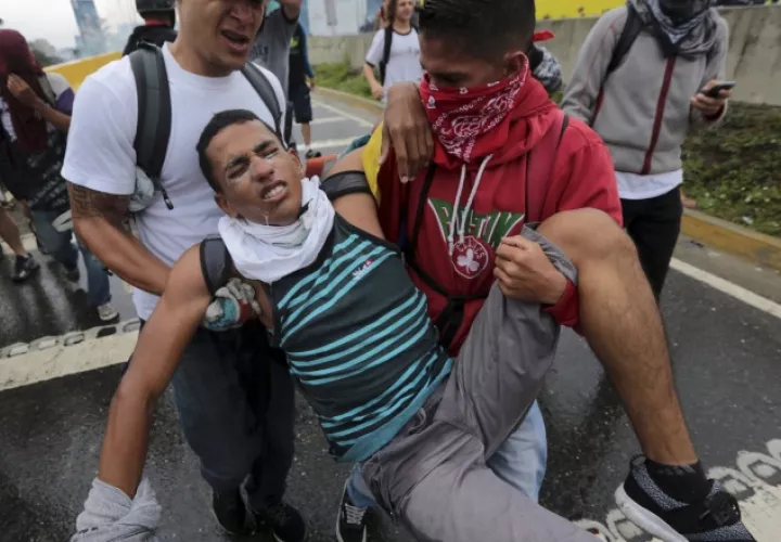 Afectado por  gas lacrimógeno. /Foto AP