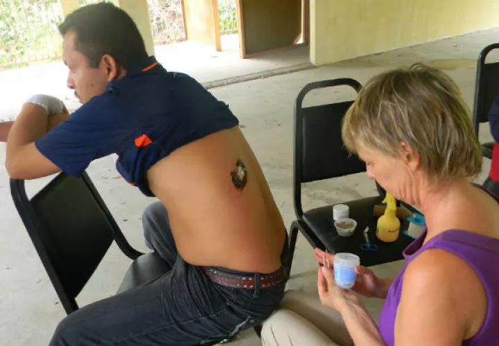 Afectado por Leishmianasis. Foto: Eric A. Montenegro 