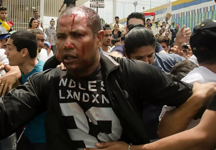 Teniente de la GNB en condición de retiro Danny José Subero (34 años) luego de ser golpeado en Cabudare. FOTO/EFE