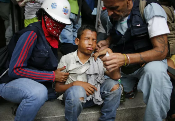 Niño afectado por los gases lacrimógenos recibe ayuda. FOTO/AP