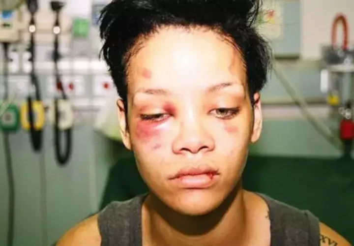 El cantante aún ama a Rihanna
