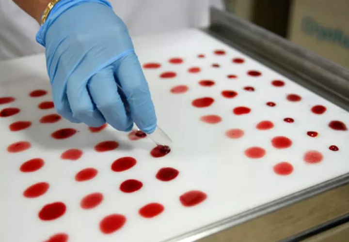 Crean en Japón método de detección en sangre de cáncer con precisión del 90 %