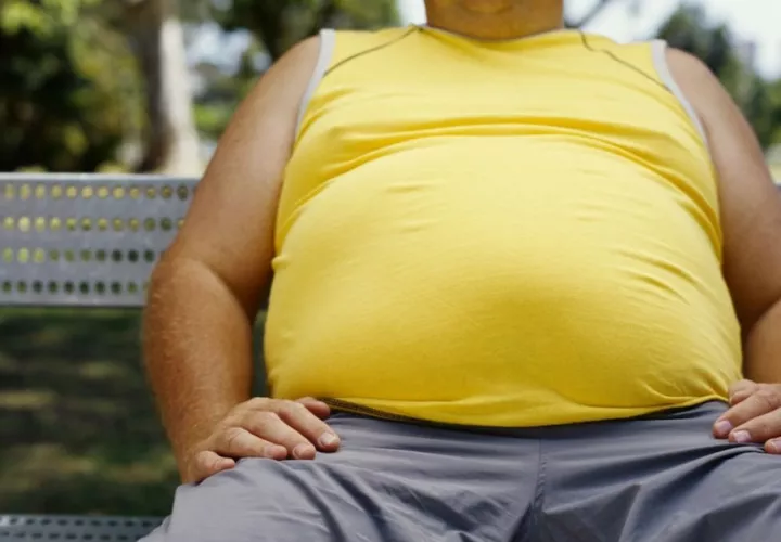 Obesidad puede aumentar incidencia de cálculos renales.