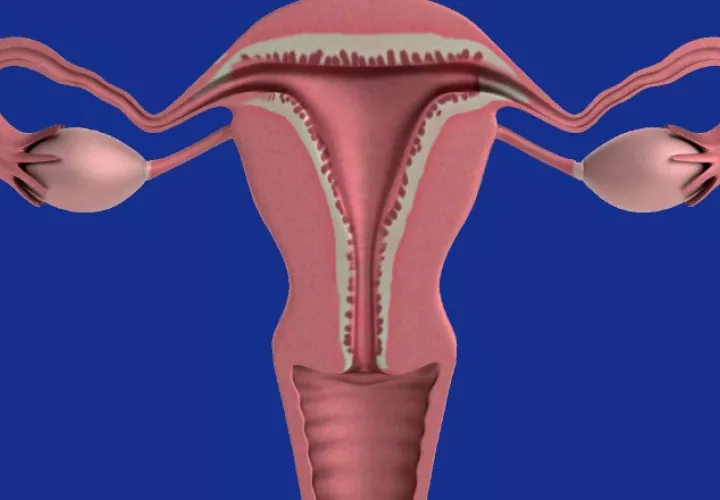 Afección del cuello uterino.