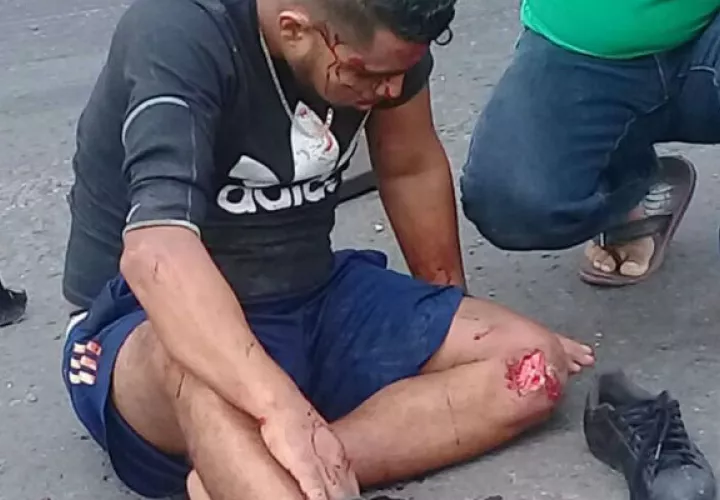Una de las personas que resultó herida en el accidente del taxi en Buena Vista, Colón. Foto/Diómedes Sánchez 
