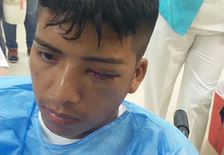 El Ministro de Seguridad, Alexis Bethancourt, se comprometió en brindar una ayuda económica a este joven. Foto: Epasa.