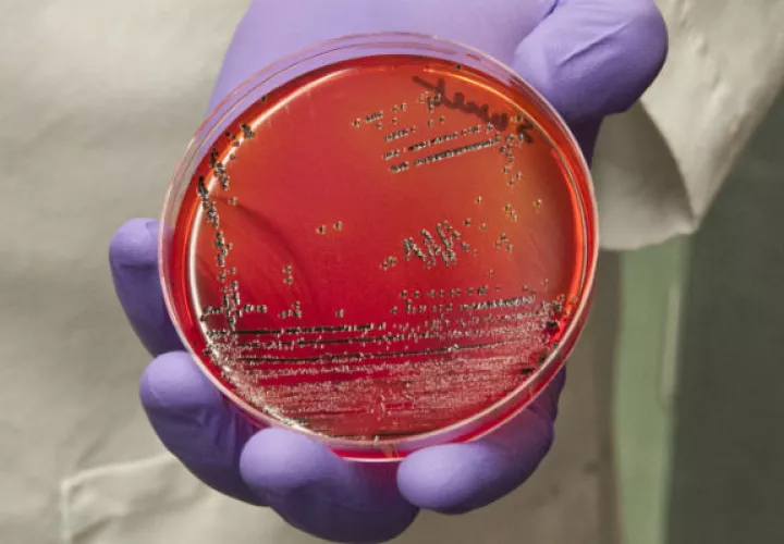 En un experimento reciente, investigadores usaron una enzima para matar la Salmonella, bacteria común (arr.). Foto/ Michael J. Ermarth/Dirección de Alimentos y Medicamentos de EU.